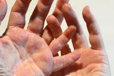 Jak správně pečovat o popraskané ruce?